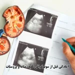 آمادگی قبل از سونوگرافی کلیه، مثانه و پروستات